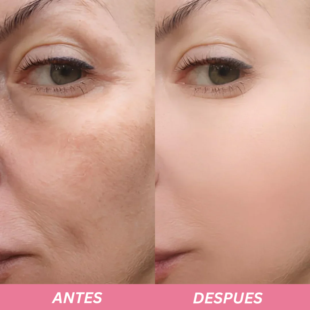 Merraci™ Rice Ampoule – Gentle Exfoliation & Radiant Skin