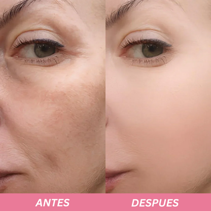 Merraci™ Rice Ampoule – Gentle Exfoliation & Radiant Skin