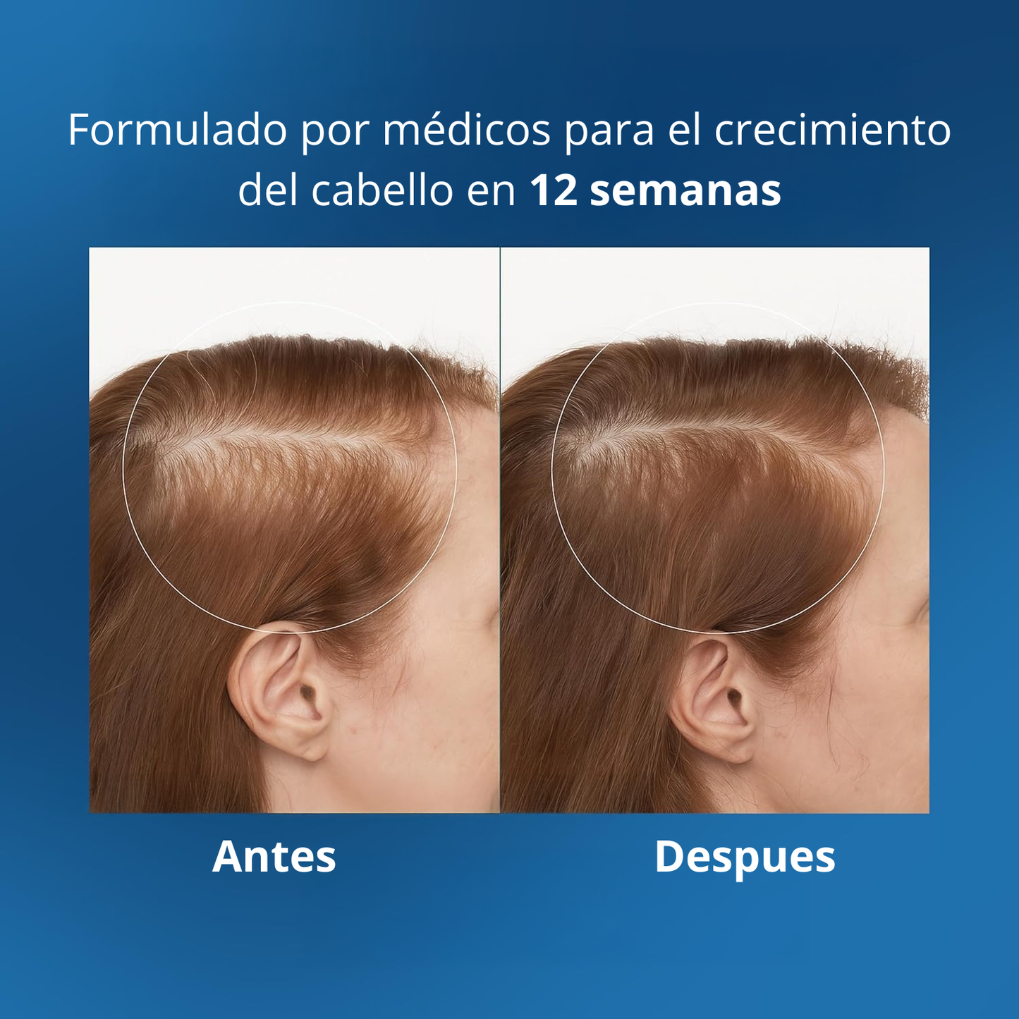 Merraci™ Sérum Capilar Roll-On – Crecimiento y Nutrición