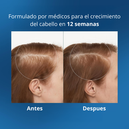 Merraci™ Sérum Capilar Roll-On – Crecimiento y Nutrición