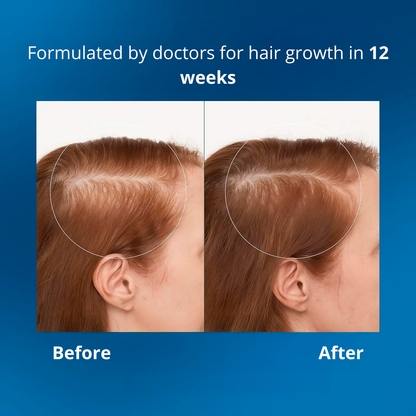 Merraci™ Roll-On Hair Serum – Growth and Nourishment