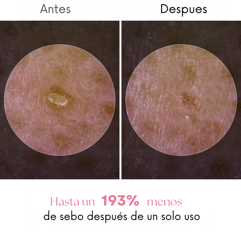 Merraci™ Rice Ampoule – Gentle Exfoliation & Radiant Skin